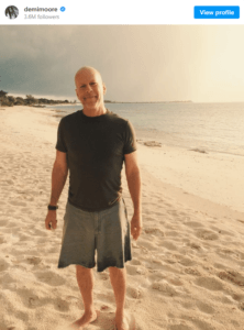 Bruce Willis frontotemporal dementia